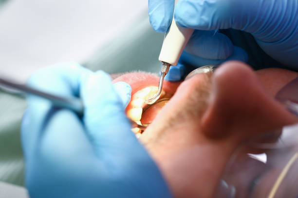 Best Broken or Chipped Tooth Repair in Dadeville, AL